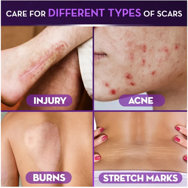 Cicatricure Face & Body Scar Gel